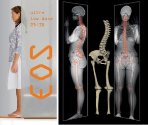 EOS in Neuromed